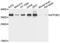 General Transcription Factor IIE Subunit 2 antibody, A8732, ABclonal Technology, Western Blot image 