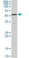 Aladin WD Repeat Nucleoporin antibody, H00008086-D01P, Novus Biologicals, Western Blot image 