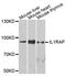 Interleukin 1 Receptor Accessory Protein antibody, A5349, ABclonal Technology, Western Blot image 