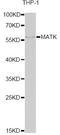 Megakaryocyte-Associated Tyrosine Kinase antibody, A6651, ABclonal Technology, Western Blot image 