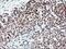 Ring Finger Protein 113B antibody, MA5-25822, Invitrogen Antibodies, Immunohistochemistry frozen image 