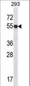 General Transcription Factor IIE Subunit 1 antibody, LS-C166724, Lifespan Biosciences, Western Blot image 