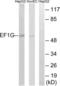 Eukaryotic Translation Elongation Factor 1 Gamma antibody, LS-C119948, Lifespan Biosciences, Western Blot image 