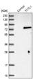 Transketolase Like 1 antibody, NBP1-86939, Novus Biologicals, Western Blot image 