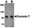 Coronin 7 antibody, orb75651, Biorbyt, Western Blot image 