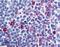 C-C Motif Chemokine Receptor 8 antibody, LS-A359, Lifespan Biosciences, Immunohistochemistry frozen image 