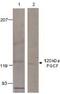 Guanylate Cyclase 2F, Retinal antibody, GTX14789, GeneTex, Western Blot image 