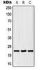 Sodium Voltage-Gated Channel Beta Subunit 2 antibody, orb214556, Biorbyt, Western Blot image 