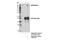 ABCC3 antibody, 39909S, Cell Signaling Technology, Immunoprecipitation image 