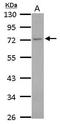 Tubulin Gamma Complex Associated Protein 4 antibody, GTX115949, GeneTex, Western Blot image 