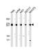 Filamin B antibody, M02562, Boster Biological Technology, Western Blot image 