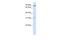 Leucine Rich Repeat Containing 8 VRAC Subunit B antibody, A12286, Boster Biological Technology, Western Blot image 