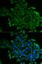 SET Domain Bifurcated Histone Lysine Methyltransferase 1 antibody, orb247285, Biorbyt, Immunofluorescence image 