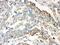 Wnt Family Member 2B antibody, PB9462, Boster Biological Technology, Immunohistochemistry paraffin image 