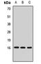 Mediator Complex Subunit 21 antibody, orb411930, Biorbyt, Western Blot image 