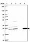 UMP-CMP kinase antibody, NBP2-33692, Novus Biologicals, Western Blot image 