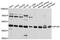 Adaptor Related Protein Complex 1 Subunit Mu 1 antibody, abx136039, Abbexa, Western Blot image 