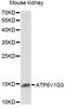 V-type proton ATPase subunit G 3 antibody, A14443, ABclonal Technology, Western Blot image 
