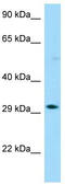 Olfactory Receptor Family 13 Subfamily G Member 1 antibody, TA331344, Origene, Western Blot image 