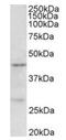 Protein Arginine Methyltransferase 6 antibody, orb12306, Biorbyt, Western Blot image 
