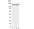 Phospholipase A2 Group IVA antibody, R31157, NSJ Bioreagents, Western Blot image 