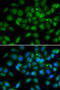 Late Cornified Envelope Like Proline Rich 1 antibody, STJ29228, St John