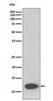 FKBP Prolyl Isomerase 1A antibody, M04492, Boster Biological Technology, Western Blot image 