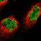 Transcriptional repressor p66-beta antibody, HPA017015, Atlas Antibodies, Immunofluorescence image 