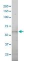 Dynein Axonemal Intermediate Chain 2 antibody, H00064446-M01, Novus Biologicals, Western Blot image 