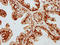 Dishevelled Segment Polarity Protein 2 antibody, LS-C375617, Lifespan Biosciences, Immunohistochemistry paraffin image 