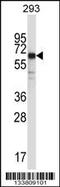 Synaptotagmin 6 antibody, 57-111, ProSci, Western Blot image 