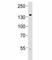 Transient Receptor Potential Cation Channel Subfamily M Member 8 antibody, F51112-0.4ML, NSJ Bioreagents, Western Blot image 