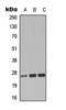 Chloride Intracellular Channel 3 antibody, orb393246, Biorbyt, Western Blot image 