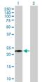 GLIPR1 Like 1 antibody, H00256710-B03P, Novus Biologicals, Western Blot image 