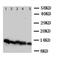 NADH:Ubiquinone Oxidoreductase Subunit A1 antibody, orb76175, Biorbyt, Western Blot image 
