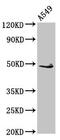 Ectodysplasin A Receptor antibody, CSB-PA892357LA01HU, Cusabio, Western Blot image 
