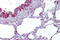 Gamma-Aminobutyric Acid Type A Receptor Beta3 Subunit antibody, ARP35339_P050, Aviva Systems Biology, Immunohistochemistry paraffin image 