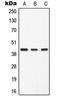 Alpha-2-Glycoprotein 1, Zinc-Binding antibody, LS-C351863, Lifespan Biosciences, Western Blot image 