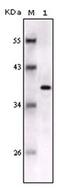 S100 Calcium Binding Protein B antibody, AM06189SU-N, Origene, Western Blot image 