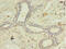 Acyl-CoA Synthetase Long Chain Family Member 4 antibody, CSB-PA060488EA01HU, Cusabio, Immunohistochemistry paraffin image 