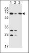 Dihydrolipoamide S-Acetyltransferase antibody, PA5-25260, Invitrogen Antibodies, Western Blot image 