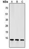 Follicle Stimulating Hormone Subunit Beta antibody, orb256542, Biorbyt, Western Blot image 