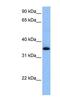 Chimerin 2 antibody, NBP1-55094, Novus Biologicals, Western Blot image 