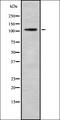 G Protein-Coupled Receptor 6 antibody, orb335564, Biorbyt, Western Blot image 