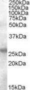 Activation Induced Cytidine Deaminase antibody, PA5-18913, Invitrogen Antibodies, Western Blot image 