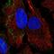Parvin Beta antibody, NBP2-57479, Novus Biologicals, Immunocytochemistry image 