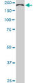 CDC42 Binding Protein Kinase Beta antibody, LS-C133593, Lifespan Biosciences, Western Blot image 