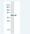 Glycogen Synthase 2 antibody, H00002998-M06, Novus Biologicals, Western Blot image 