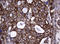 TNF Receptor Superfamily Member 8 antibody, LS-C175668, Lifespan Biosciences, Immunohistochemistry frozen image 