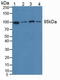 Eukaryotic Translation Elongation Factor 2 antibody, LS-C725560, Lifespan Biosciences, Western Blot image 